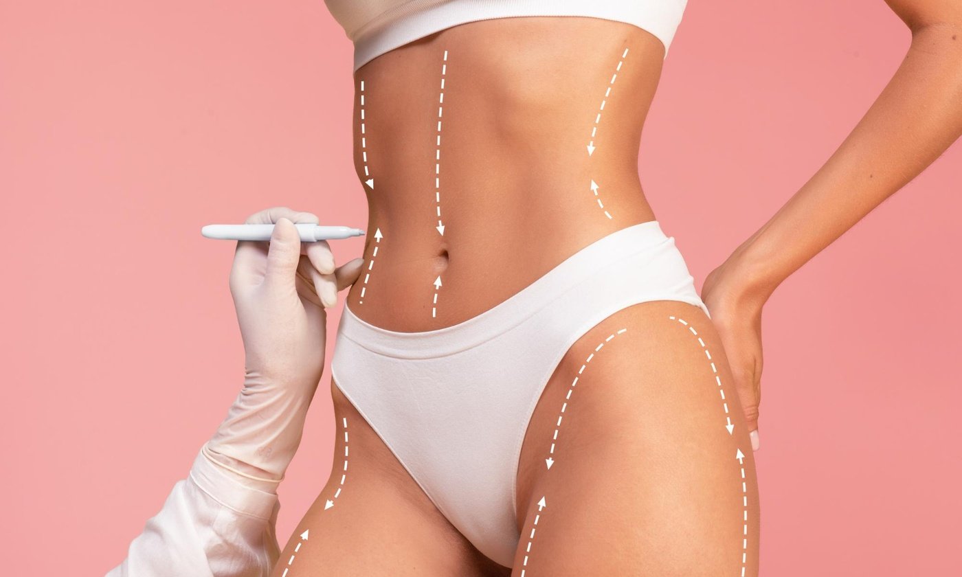The Science of Chemical Lipolysis – Mastering Non-Surgical Body Contouring with Fillora.store